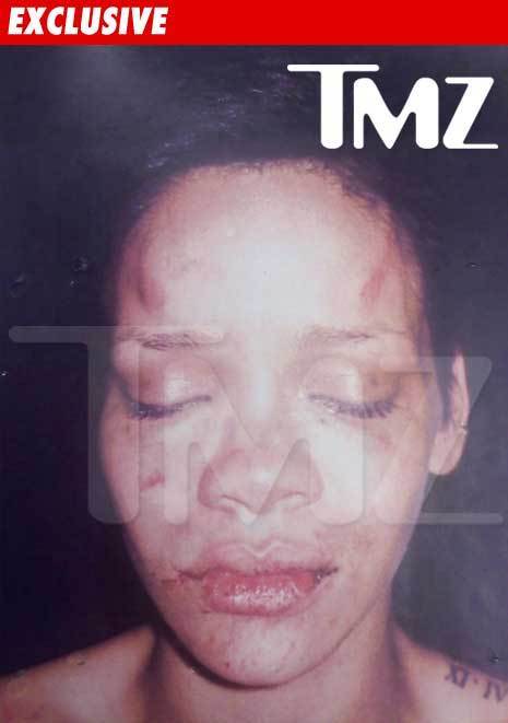 Rihanna Battered Photo